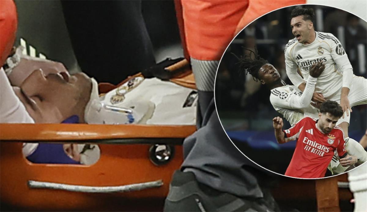 الكشف عن تشخيص إصابة أسينسيو ريال مدريد: ضربة موجعة للملكي قبل لقاء خيتافي